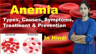 Anemia  Types of Anemia  Causes Symptoms Treatment Prevention Risk Factors  In Hindi [upl. by Neville]