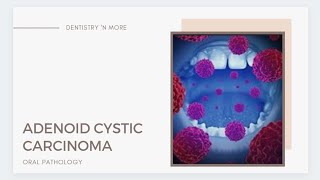 ADENOID CYSTIC CARCINOMA [upl. by Aiekat]