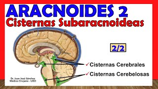 🥇 ARACNOIDES 22  Cisternas Subaracnoideas ¡Explicación Sencilla [upl. by Gross332]