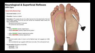 Plantar Reflex amp the Babinski Sign EXPLAINED [upl. by Wilkison225]