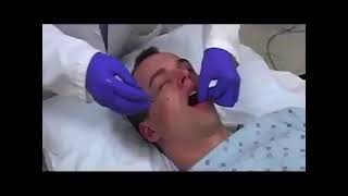 How to insert an Oropharyngeal Airway360P [upl. by Encratia713]