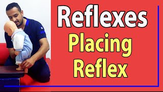 23 Placing stepping Reflex [upl. by Tenneb975]