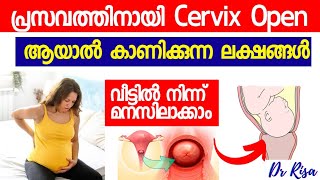 Cervix Open Symptoms Malayalam  Last Month Of Pregnancy Symptoms [upl. by Tjader]