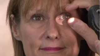 Ophthalmics Video 6  Eye Exam [upl. by Jez]