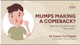 Mumps Causes Symptoms and Treatments  Dr Samar Sen P  Arete Hospitals mumps [upl. by Alemak]