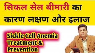 What is Sickle Cell Disease and its Cause Symptoms and Treatment  in Hindi [upl. by Hadeehuat]