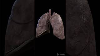 What a smokers lung looks like anatomy meded [upl. by Tem]