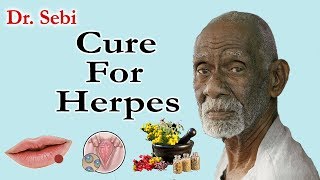 How Dr Sebi Cured Herpes  Complete Guide To Dr Sebi Cure For Herpes [upl. by Onej]