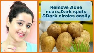 Remove DARK SPOTS ACNE SCARS DARK CIRCLES amp PIGMENTATION Fast in 2 Simple Steps in 5 days [upl. by Hocker]