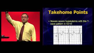 EEM 2019 Hypokalemia You thought you knew how to recognize it [upl. by Ahsaeit249]