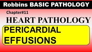 Chp11 Robbins Patho  Heart Pathology  Pericardial Effusion  Dr Asif Lectures [upl. by Pournaras]