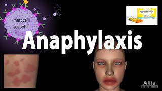 Anaphylaxis Animation [upl. by Saire909]