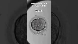 Early development of human  Cleavage  morula  blastulation [upl. by Isahella64]