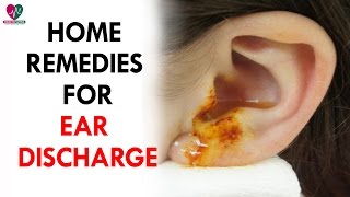 Home Remedies for Ear Discharge  Health Sutra [upl. by Naillij]