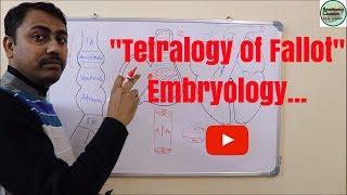 Embryological basis of Tetralogy of Fallot [upl. by Enivid]