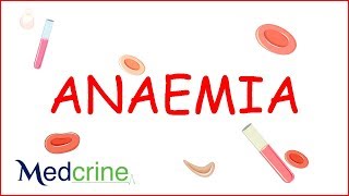 Anemia  causes classification clinical features treatment [upl. by Airdnal]