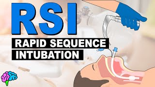 What is Rapid Sequence Intubation RSI [upl. by Dinny]