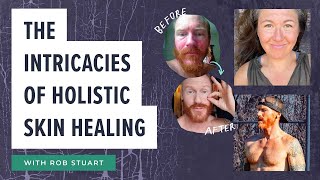 The intricacies of holistic skin healing with Rob Stuart [upl. by Llorre]