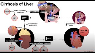 LiverCirrhosisAscites1cPathophysiology [upl. by Raskind]