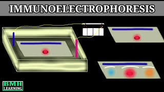 Immunoelectrophoresis [upl. by Aled817]