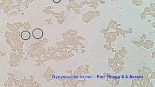 Trypanosoma evansi  parte 2 [upl. by Siffre]