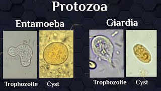 microscopical exam Protozoal trophozoites amp cysts [upl. by Alekahs]