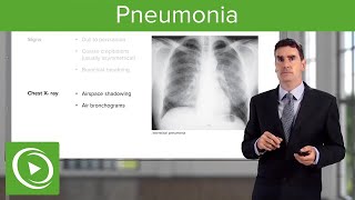 Pneumonia Types Classification Symptoms amp Management  Respiratory Medicine [upl. by Sidky771]