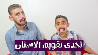 تحدى تقويم الاسنان  Orthodontic Challenge [upl. by Adlez]