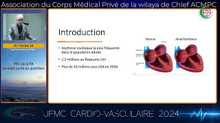 Pr TAHMI MOHAMED  Fibrillation atriale du sujet jeune [upl. by Estey]