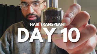 Day 10 Hair Transplant Journey  Some Normality 😌 [upl. by Old]