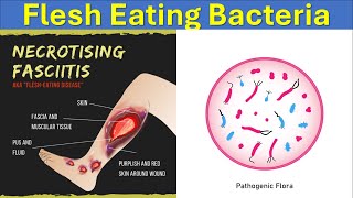 What Are Flesh Eating Bacteria  Causes Symptoms and Treatments Of Necrotizing Fasciitis [upl. by Ilise]