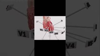 ECG Leads placement ecg ecglead heart echo shortsfeed shorts ytshorts [upl. by Eedissac]