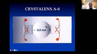 Lecture Surgical Correction of Presbyopia [upl. by Gerardo]