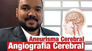 Aneurisma Angiografia Cerebral Precisa fazer para confirmar [upl. by Yhtir154]