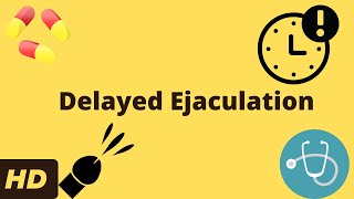 Delayed Ejaculation What You Need To Know [upl. by Sneed390]