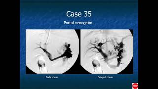 RADIOLOGY EXAM CASES [upl. by Gnehc]