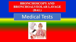 BRONCHOSCOPY AND BRONCHOALVEOLAR LAVAGE BAL [upl. by Rodolfo649]