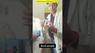 Stool Microscopic Examination  Stool Routine Test  stool stools shorts short viral ascari [upl. by Anaer]