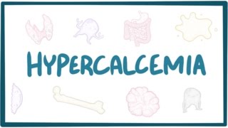 Hypercalcemia  causes symptoms diagnosis treatment pathology [upl. by Ydasahc]