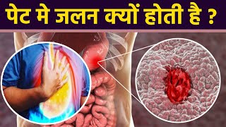 पेट में जलन क्यों होती है । पेट में जलन का कारण । Boldsky Health [upl. by Luiza583]