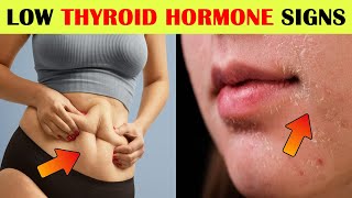 7 Signs Youre Low On Thyroid Hormone [upl. by Nylsirhc162]