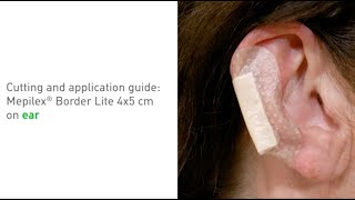 Mepilex Border Lite  application on ear [upl. by Tennaj]