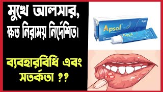 মুখের আলসার দূর করে যে মেডিসিন Apsol oral pest Review bangla  Apthous Ulcer Treatment Bangla [upl. by Fleur]