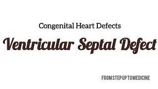 Ventricular Septal Defect  Medicine KMU lecture  Urdu amp Hindi [upl. by Issej]