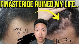 FINASTERIDE RUINED MY LIFE AND HAIR [upl. by Harutak]