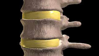 How Slipped Discs Happen Animation What’s Herniation  Herniated Nucleus Pulposus Bulging Disc Video [upl. by Henriha]