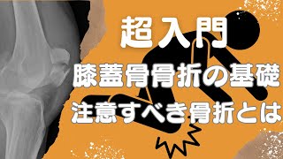 【超入門】膝蓋骨骨折の基礎と注意すべき骨折の種類 [upl. by Constancy759]