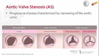 Pathophysiology of AorticValve Stenosis [upl. by Koloski]