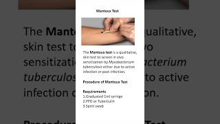 Mantoux test procedure [upl. by Normand]