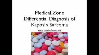 Medical Zone  Differential Diagnosis of Kaposis Sarcoma [upl. by Eterg908]